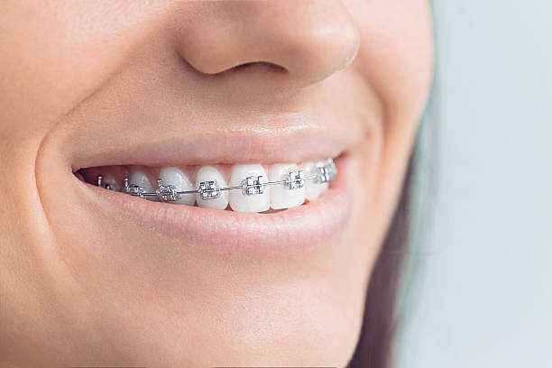 Best Veneers and Lumineers  in Jacinto City, TX